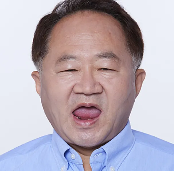 최**님 60대 치료 전