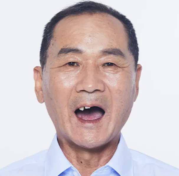 정**님 60대 치료 전