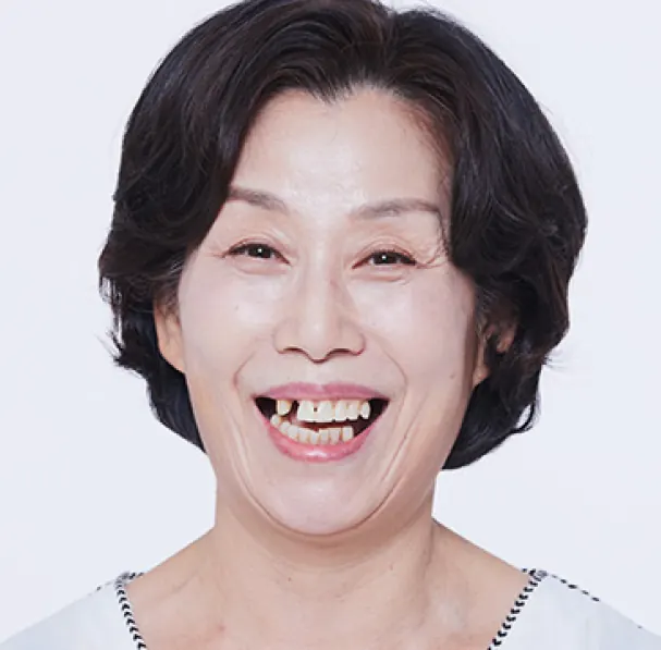 정**님 60대 치료 전