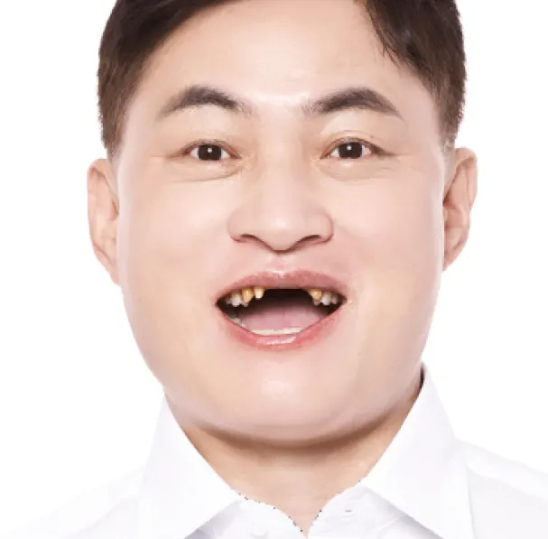 이**님 40대 치료 전