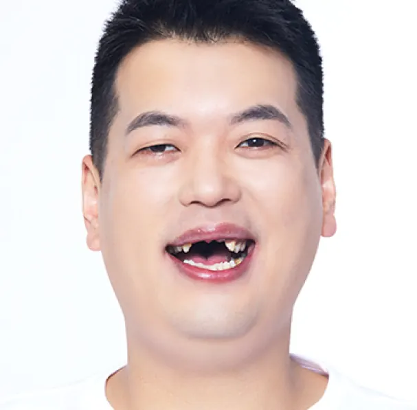 박**님 30대 치료 전